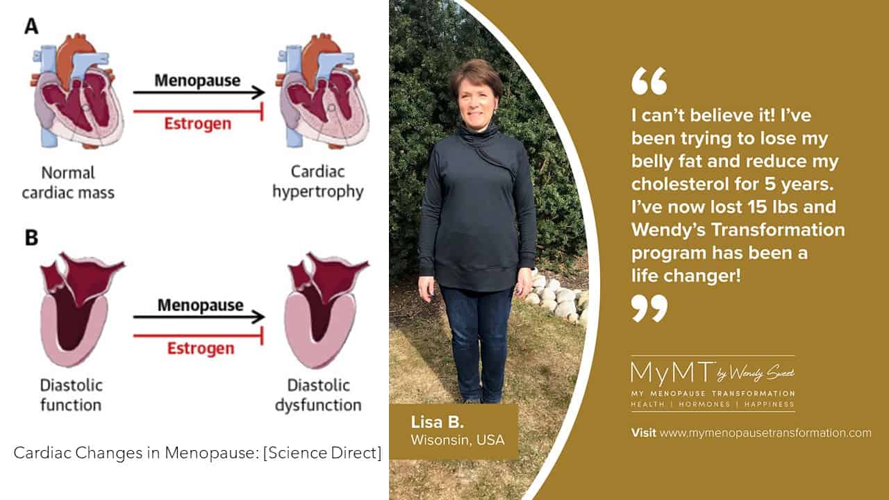 Cardiac Changes in Menopause and Lisa