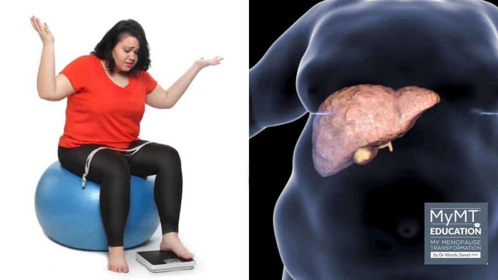Woman on swiss ball and fatty liver in obesity